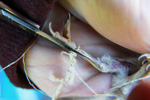 Das Foto zeigt den Fuß eines jungen Feldsperlings, von dem ein Stück Faden abgeschnitten wird.